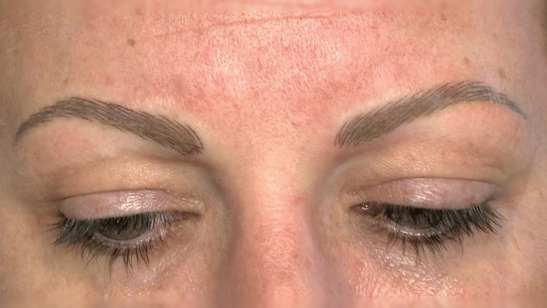 Corrective 2 - After