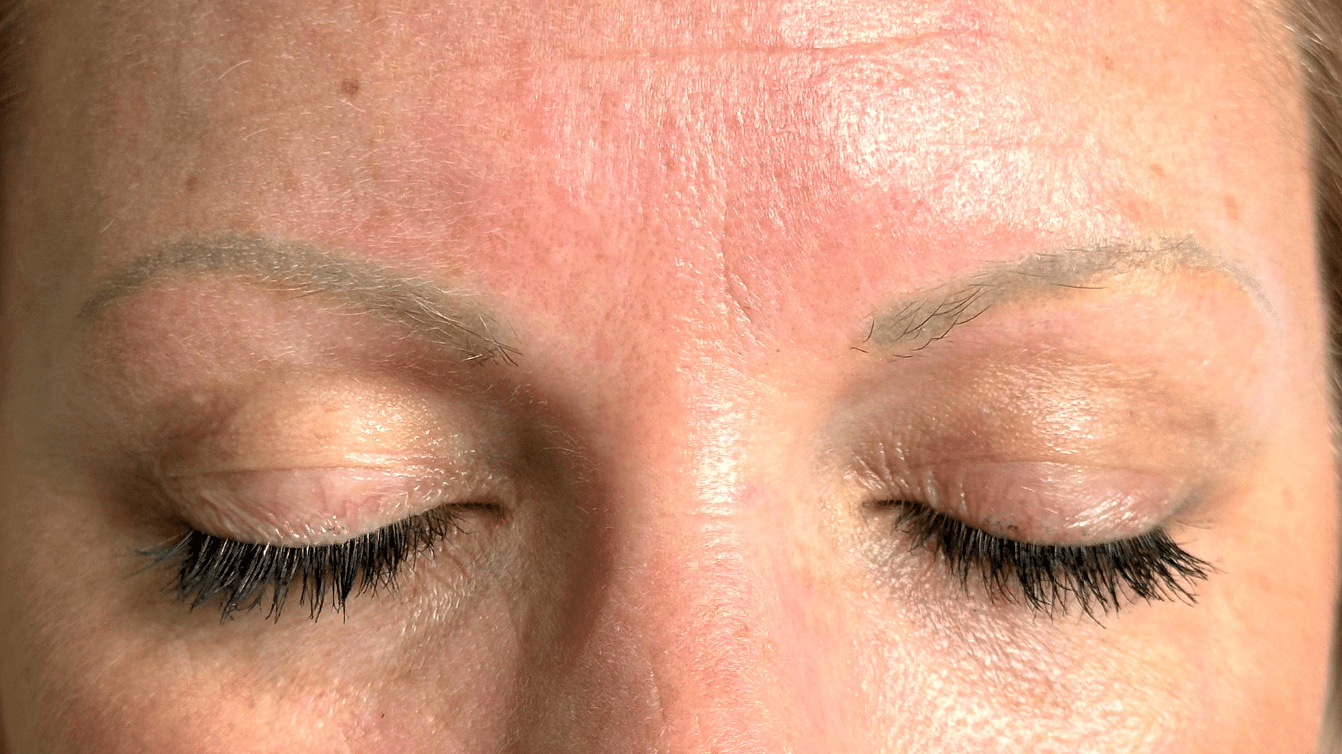 Corrective 2 - Before