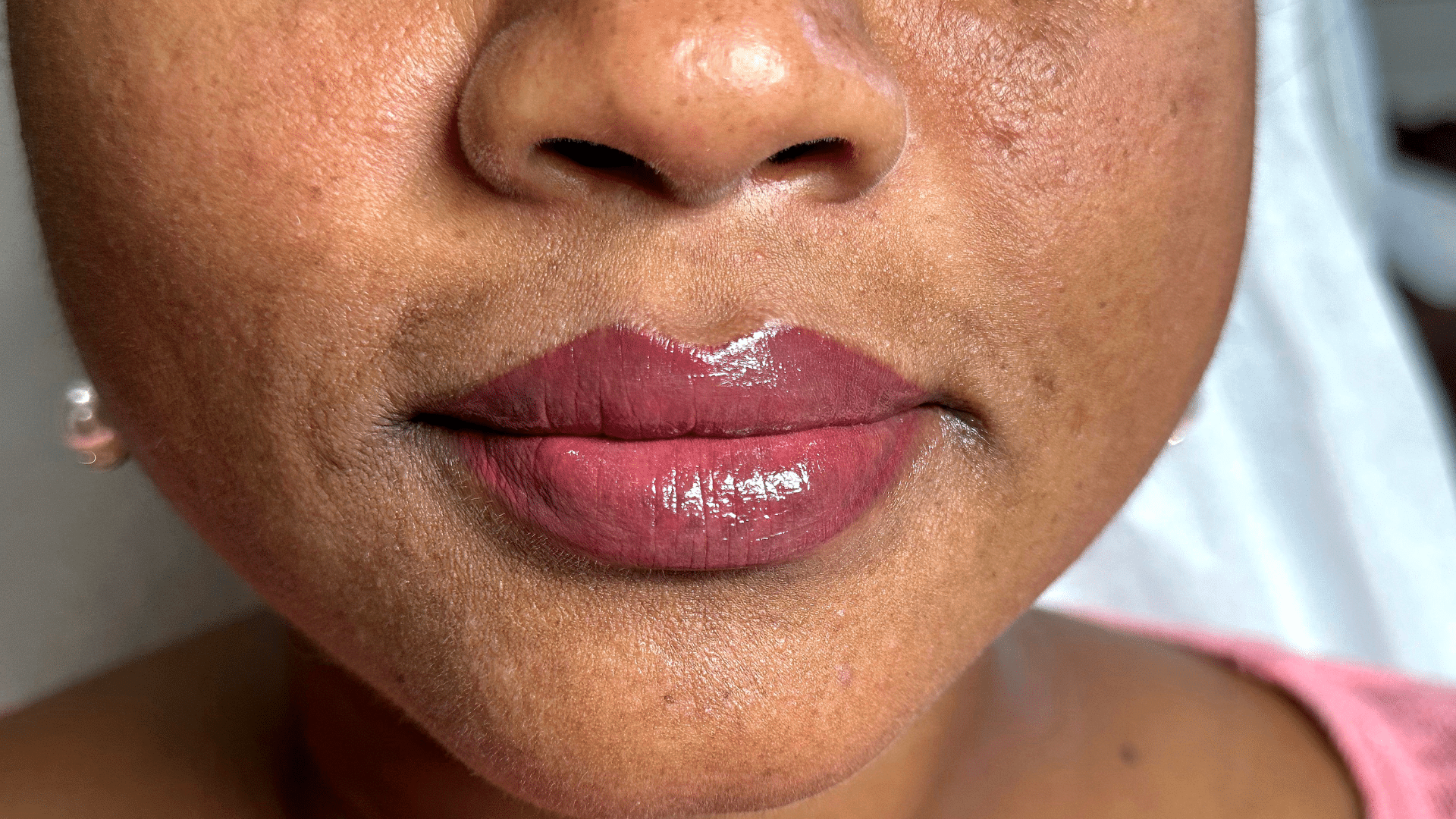 Paramedical 1 - After