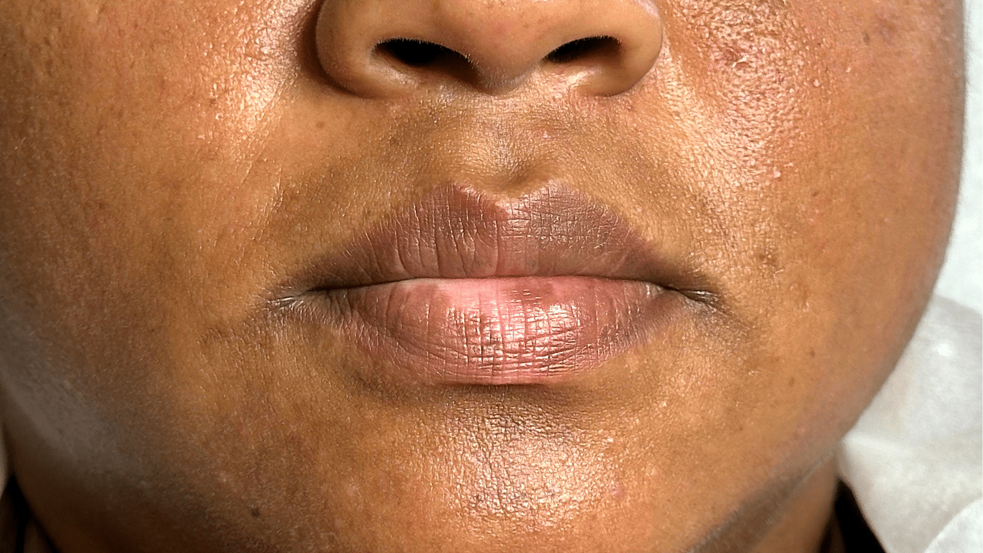 Paramedical 1 - Before